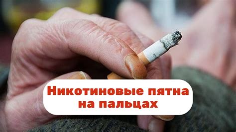 Популярные способы удаления никотиновых пятен