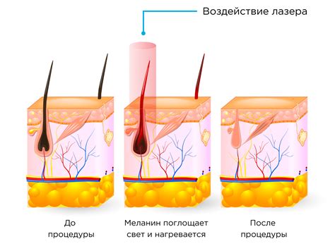 Последствия недопустимой эпиляции