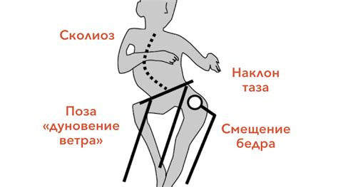 Последствия неправильной позы