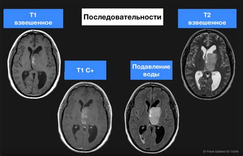 Пост и патологии