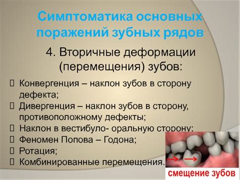 Потеря зубов и нарушение речи