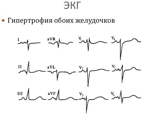 Почему назначают ЭКГ: обзор показаний