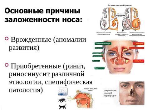 Почему перегружен нос