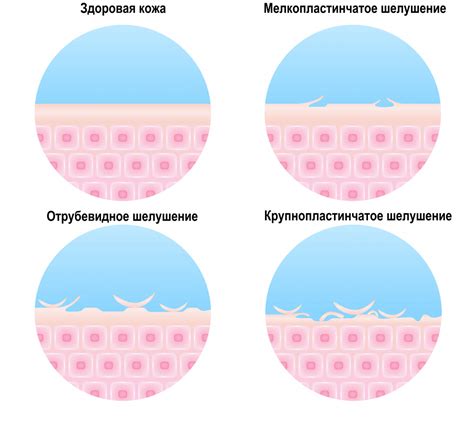 Предотвращает обезвоживание и шелушение кожи