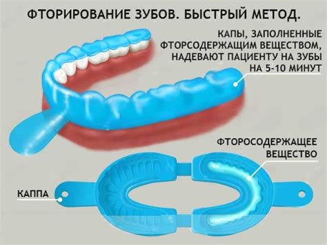 Преимущества биокерамической эмали