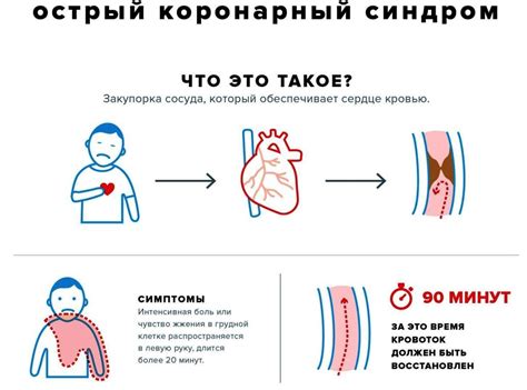 Признаки синдрома в организме: