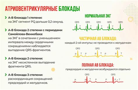 Причины возникновения блокады на ЭКГ у детей