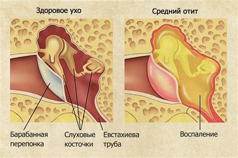 Причины возникновения хлопающего звука при глотании: