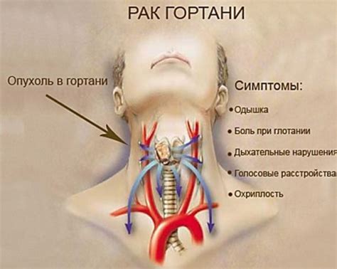 Причины дискомфорта у кошачьего горла