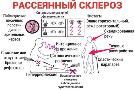 Причины нарушения вестибулярного аппарата