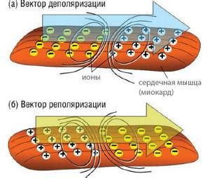 Причины нарушения реполяризации миокарда