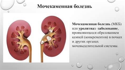 Причины формирования недостаточно отражающих звук пирамидок в органах мочевыделительной системы