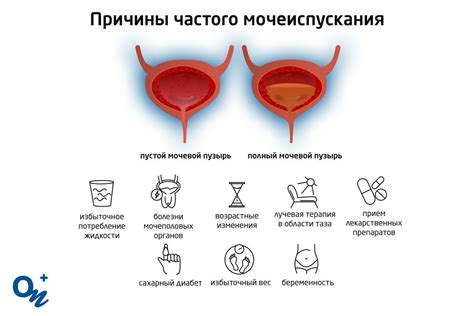 Причины частого мочеиспускания: