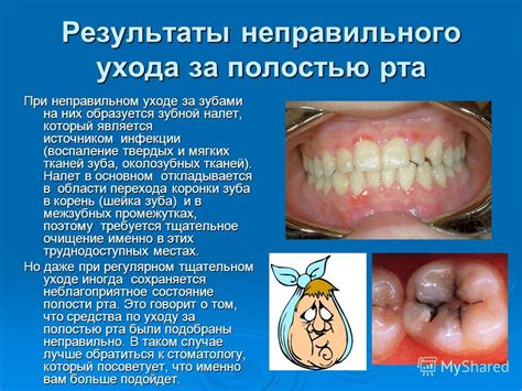 Проблемы с зубами и ротовой полостью