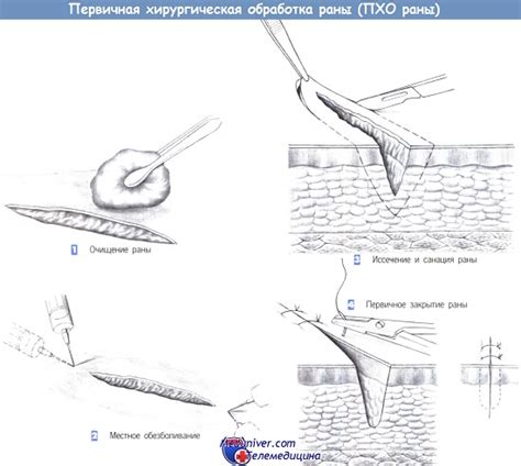 Проведите медицинскую обработку раны