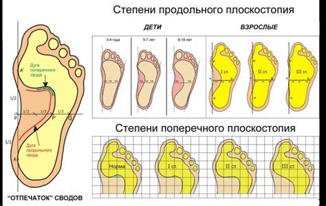 Проверьте стопу на наличие иголок