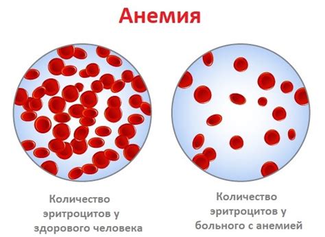 Профилактика анемии