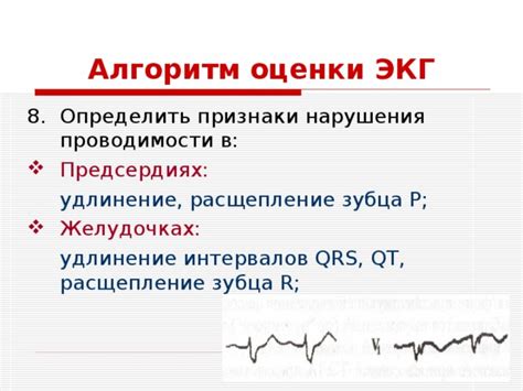 Профилактика нарушения проводимости в желудочках