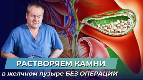 Профилактика образования камней в миндалинах