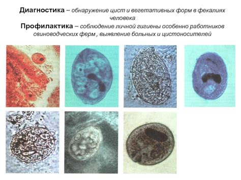 Профилактика цист