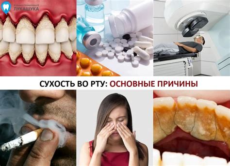 Психологические факторы, приводящие к сухости во рту