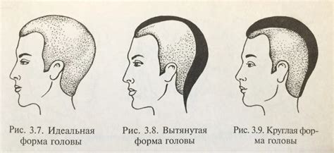 Психосоциальные последствия изменения формы головы