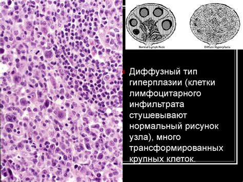 Развитие симптомов при повышении размера лимфоидных тканей после операции