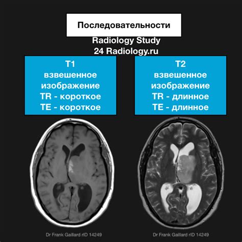 Различия между тарифными зонами Т1 и Т2