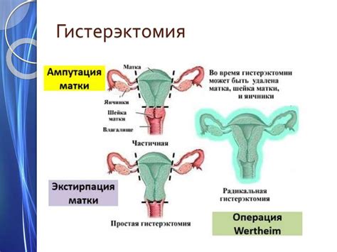 Различные патологии матки и яичников