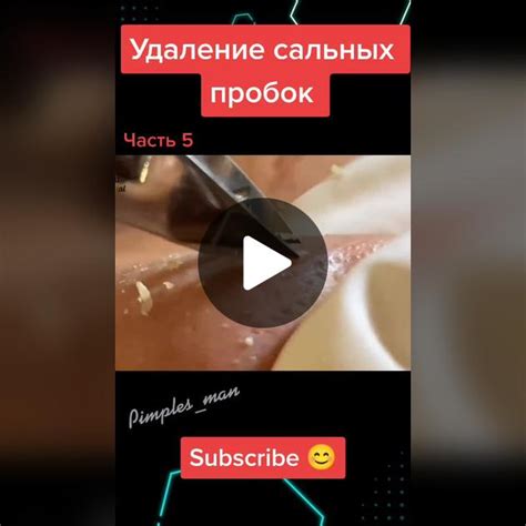 Раскрытие пор и удаление пыли, сальных пробок