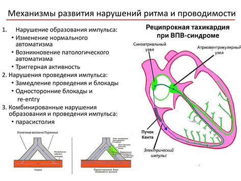 Распознавание проявлений повышенного сердечного ритма и потенциальные осложнения