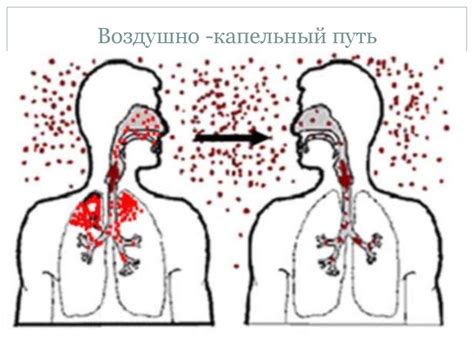 Распространение кори в обществе среди людей, перенесших болезнь