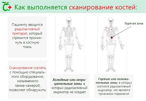 Реальные преимущества костей в морском языке для здоровья