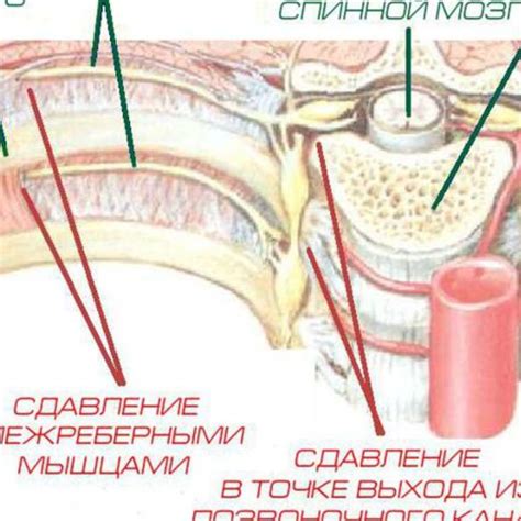 Рекомендации по проведению рентгеновских исследований защемления нерва