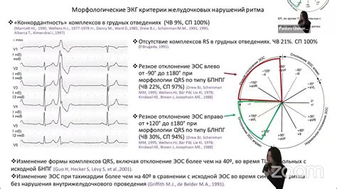 Роль контура QRS-T в сердечной экспресс-диагностике