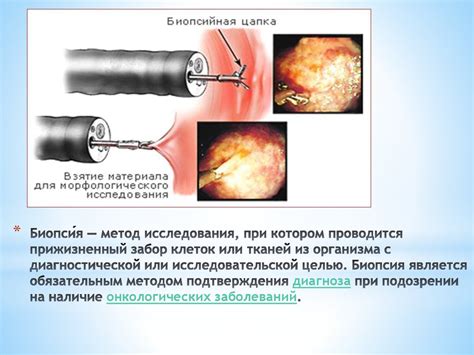 Роль ранней диагностики заболеваний