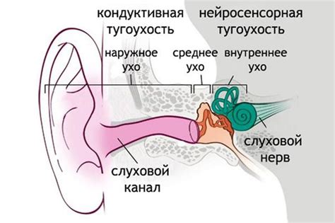 Самолеты и нейросенсорная тугоухость