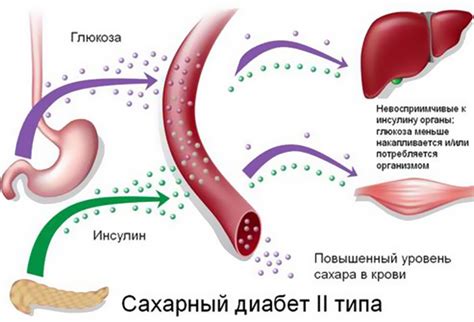 Сахарный диабет в качестве масштабной проблемы