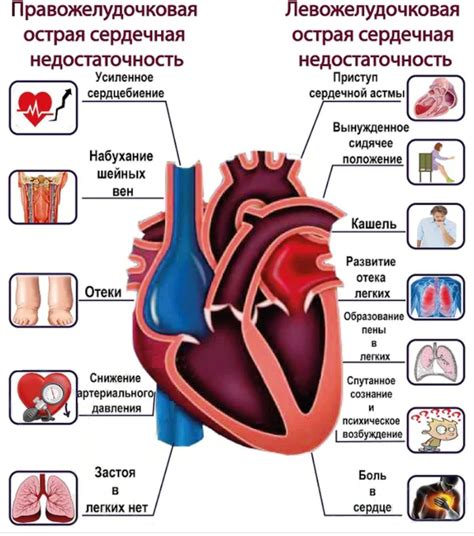 Сердечная недостаточность: основные причины и симптомы