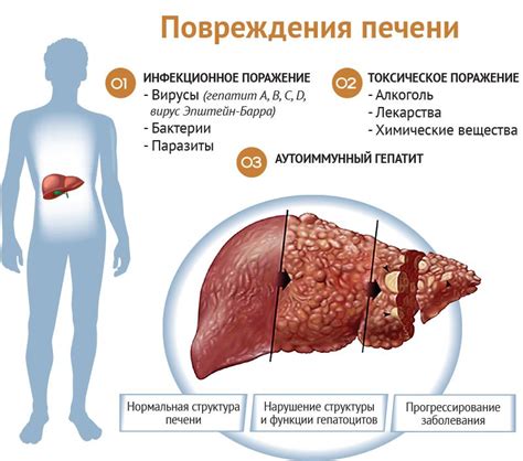 Симптомы дисфункции печени