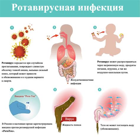 Симптомы инфекции