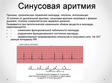 Симптомы и диагностика нарушения динамики корковых ритмов