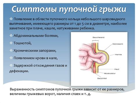 Симптомы и признаки грыжи на животе