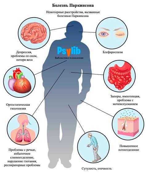Симптомы и проявления болезни Паркинсона