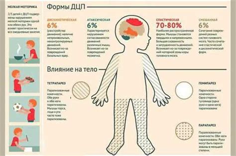 Симптомы нарушения церебрального статуса