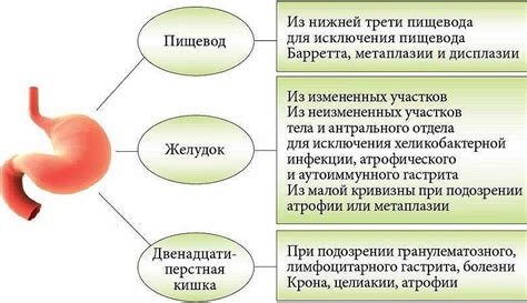 Симптомы повышенной кислотности