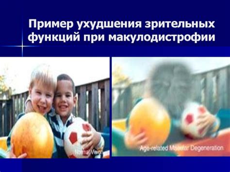 Симптомы ухудшения зрительных функций при внимательном рассмотрении