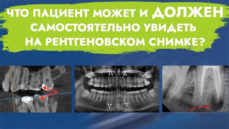 Ситуации, когда необходимо выполнить рентгеновское исследование