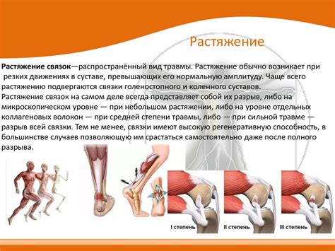 Травмы сухожилий и связок: причины и последствия