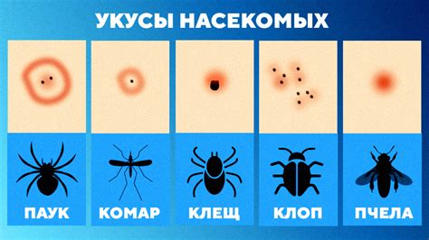 Укусы насекомых и последствия